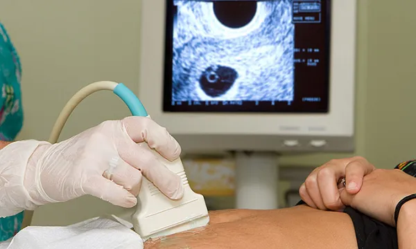 ecografia-examenmedico-salud1shut-1509241765.jpg