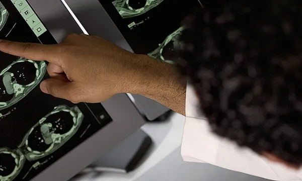 radiografia-salud-medico2think-1509241636.jpg